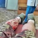 Поножовщина в Киеве: в столице молотками едва не забили до смерти защитника ДАПа