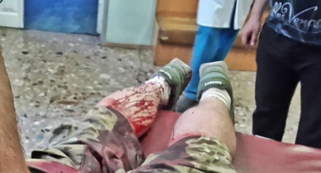 Поножовщина в Киеве: в столице молотками едва не забили до смерти защитника ДАПа