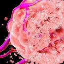 На Землю надвигается «вспышка» рака: ученые назвали самый уязвимый регион