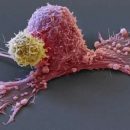 «Наследуют только мутации»: онколог рассказал о передаче рака по наследству